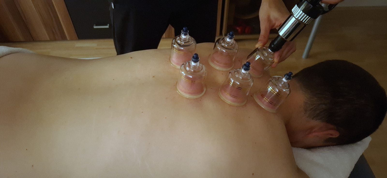 Heilmassage mit Schröpfgläsern am Rücken
